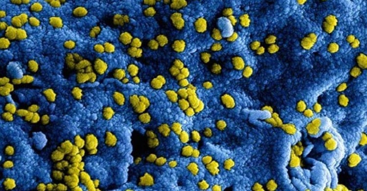 Contracten en overmacht door coronavirus | JPR Advocaten